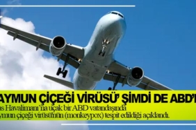 maymun-çiçeği-virüsü