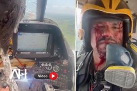 Dev kuş askeri uçağa çarptı. Pilot yüzünden yaralandı.