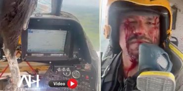 Dev kuş askeri uçağa çarptı. Pilot yüzünden yaralandı.