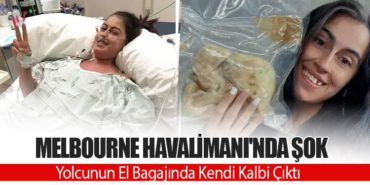 Melbourne Havalimanı’nda Şok: Yolcunun El Bagajında Kendi Kalbi Çıktı