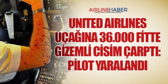 Uçakta şok! Yanındaki yolcunun kulağını ısırdı... 1 Haberler Uçak thumbnail
